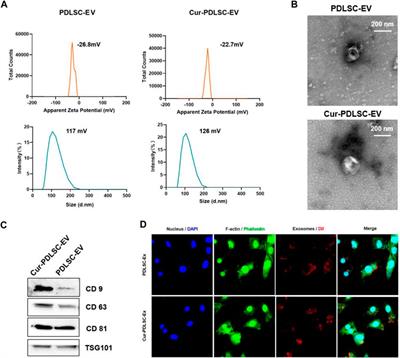 Curcumin-primed periodontal ligament stem cells-derived extracellular vesicles improve osteogenic ability through the Wnt/β-catenin pathway
